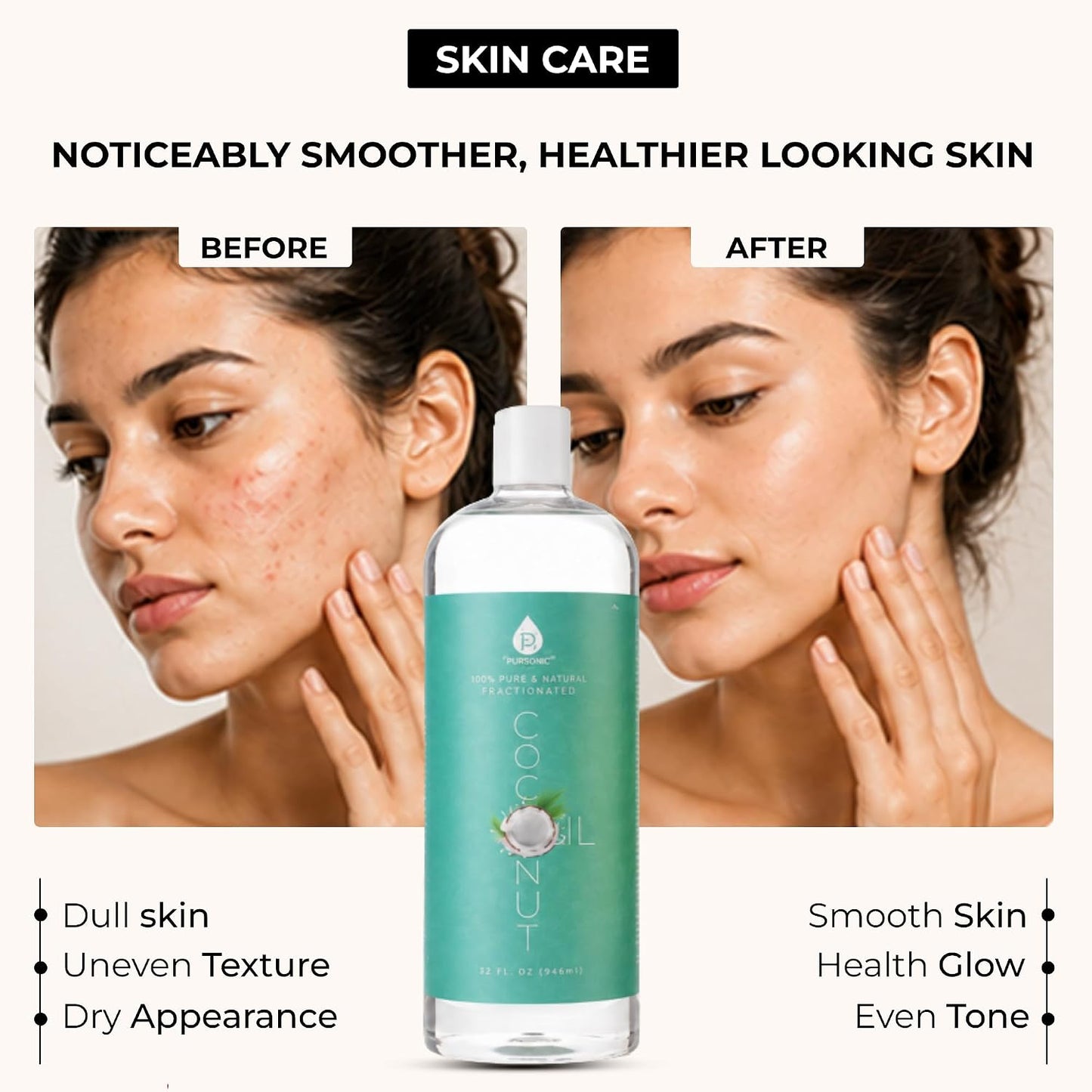Fractionated Coconut Oil - Lightweight Unscented Carrier Oil for Skin, Hair, Body Massage & Makeup Removal - Non Greasy Moisturizing Liquid for Aromatherapy and Daily Care - 32 Oz